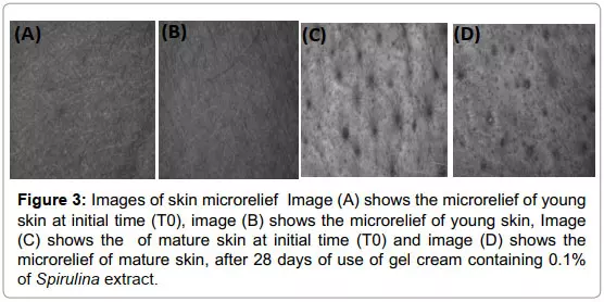 تـاثیر جلبک اسپیرولینا بر پوست4