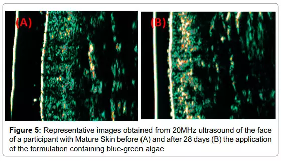 تـاثیر جلبک اسپیرولینا بر پوست6