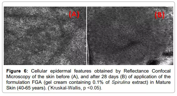 تـاثیر جلبک اسپیرولینا بر پوست7